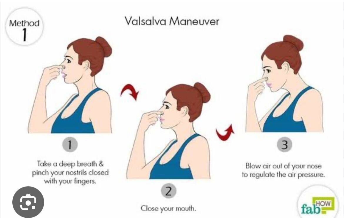 Valsalva maneuver